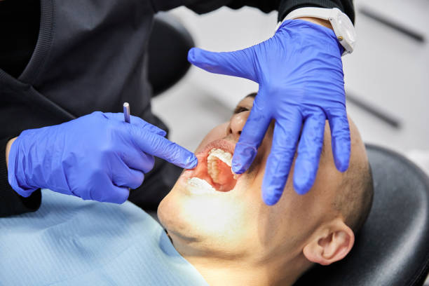 Best Emergency Tooth Extraction in Whittier, CA